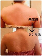 サロン ド プロデュース(salon de PRODUCE)/脇肉／二の腕／背中◇スッキリ！