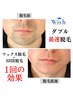 ダブル脱毛で速攻効果実感！ワックス×光脱毛　カウンセリングクーポン♪