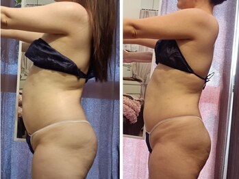 シャルマン(charmant)/グロッティプロ ボディ痩身