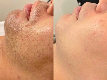 ルーナジェーナ(Luna llena)/池袋 エステ ルーナジェーナ