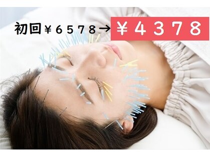 はえみ接骨院 はえみ鍼灸院の写真