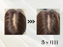 ミヨン(Miyong)の雰囲気（3か月目/育毛促進!98％の方が効果実感）
