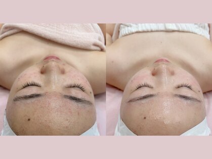 ミネット(minette)の写真