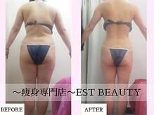 エストビューティー 池袋店(EST BEAUTY)の雰囲気（池袋の人気痩身サロン！口コミ評価◎！短期でサイズダウン！）
