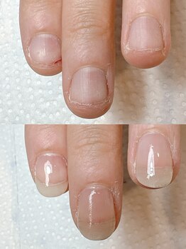 スマイルニコ(smile nico)/