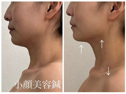 リュウ鍼灸院 サロン ド リュウ(Salon de Ryu)の写真