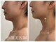 リュウ鍼灸院 サロン ド リュウ(Salon de Ryu)の写真