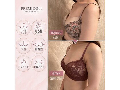 プレミドール(PREMIDOLL)の写真