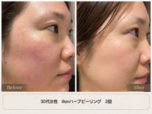 ラナ(Lana)の雰囲気（どんなお肌悩みもお任せください。）