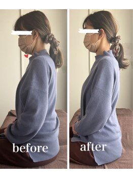 スパチャーレ(Spa ciare)/【骨盤矯正&猫背矯正】