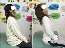 藤整体院 磐田見付院/真上を向けない首の痛みが楽に♪