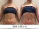 サンオーラ(SUN AURA)の写真