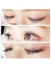 アアルズ(R’s)/