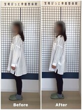 宝塚ぴっと骨盤整体院/実際のお声