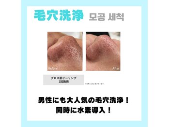 リハーツ(RE;heartz)