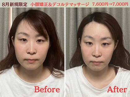 シルフィードの写真
