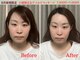 シルフィードの写真
