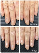 リエル(RIELE)/最強ケア♪