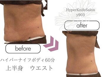 ワイキューマルサン(y903)/ハイパーナイフボディ60分上半身