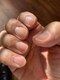 ネイルメンテナンススタジオ(Nail Maintenance Studio)の写真/爪の乾燥/割れやすい/ちび爪/深爪などのお悩みを根本改善◎健やかな自爪を育む《爪育》できれいな指先に。