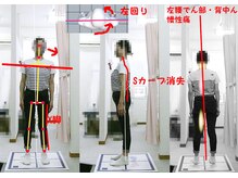 姫路なごみ整体院 なごみ鍼灸院/歪んでいる姿勢