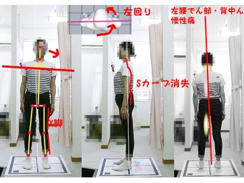 姫路なごみ整体院 なごみ鍼灸院/歪んでいる姿勢