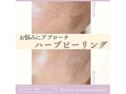 ルシアル(Rucial)の写真