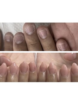 爪の悩みを解消できる（ケア含む）