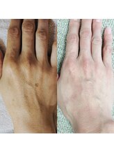 ザ シー タイムレスビューティ(THE SHE)/40代お客様症例写真