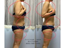 ムユウジュ(muyuju)/コースもありますが単発もok