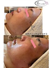 フルリール(Fleurir)/フェイシャルワックス☆