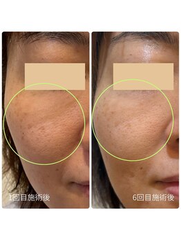 チョチョワンプラス(緒々one+)/ゆらぎがちなお肌に、美肌育成◎