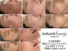 ユーエステティック(U AESTHETIC)