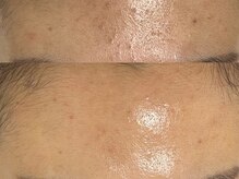 スーメ 柏(soome')/柏/まつげパーマ/眉毛/WAX