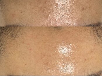 スーメ 柏(soome')/柏/まつげパーマ/眉毛/WAX