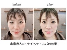 コルヴィヴィッド(cor vivid)の雰囲気（頭のもみほぐしでフェイスライン、口角、目元もパッチリ！）