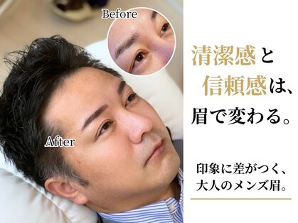 アンバーレス(AmberRes)の写真