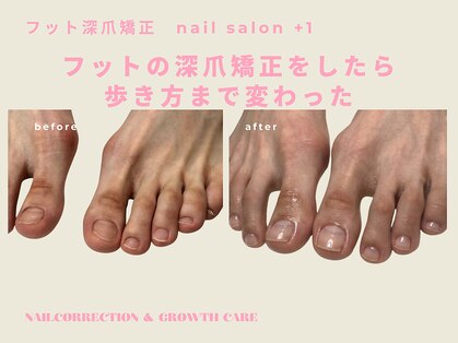 プラスワン(+1)の写真