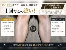 モデルズ(MODELS)の雰囲気（ヒゲが抜けるお店はどこでも効果出せます。#松山ヒゲ脱毛）