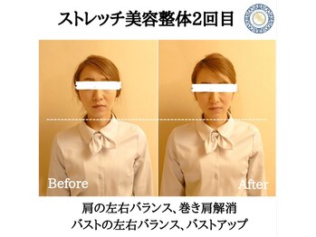 RKY/肩の左右バランス