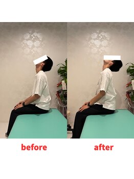 ナオル整体 福岡香椎院(NAORU整体)/30代男性施術事例【首の痛み】