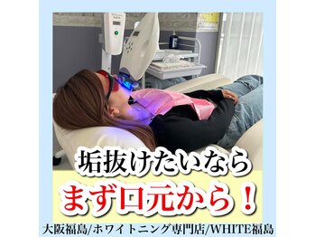 ホワイトニングサロン ホワイト(WHITE)/セルフホワイトニング/大阪/福島