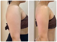 エイシスグロウ(asis glow.)/効果写真