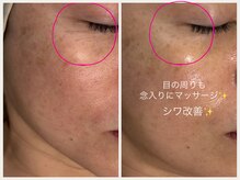 グランボヌール(grand bonheur)/【エステ　ベーシックコース】