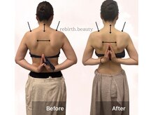 リバース 大阪店(Rebirth)の雰囲気（短期集中！肩甲骨出し・姿勢改善に特化したスリミングメニュー）