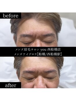 ユー 西船橋店(you)/ビフォーアフター写真