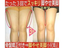 スタイル整体 やまもと整骨院の雰囲気（骨盤矯正＋下半身痩せ３回で太ももが明らかにスッキリしました！）