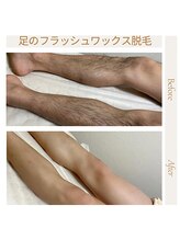 オフオルファヴォリ(OF Olu:Favori)/【フラッシュワックス脱毛】