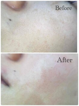 ビー 松本店(Be.. .)/ワックスで輝く素肌！