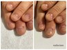 【男性：深爪】モニター価格/見た目改善で清潔感のある爪へ￥31900→23,100